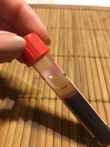 品牌牙刷大比拼实测告诉你哪款牙刷才是你的最佳选择！
